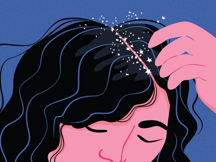 Dandruff vs. Scalp Psoriasis: How to Tell the Difference?